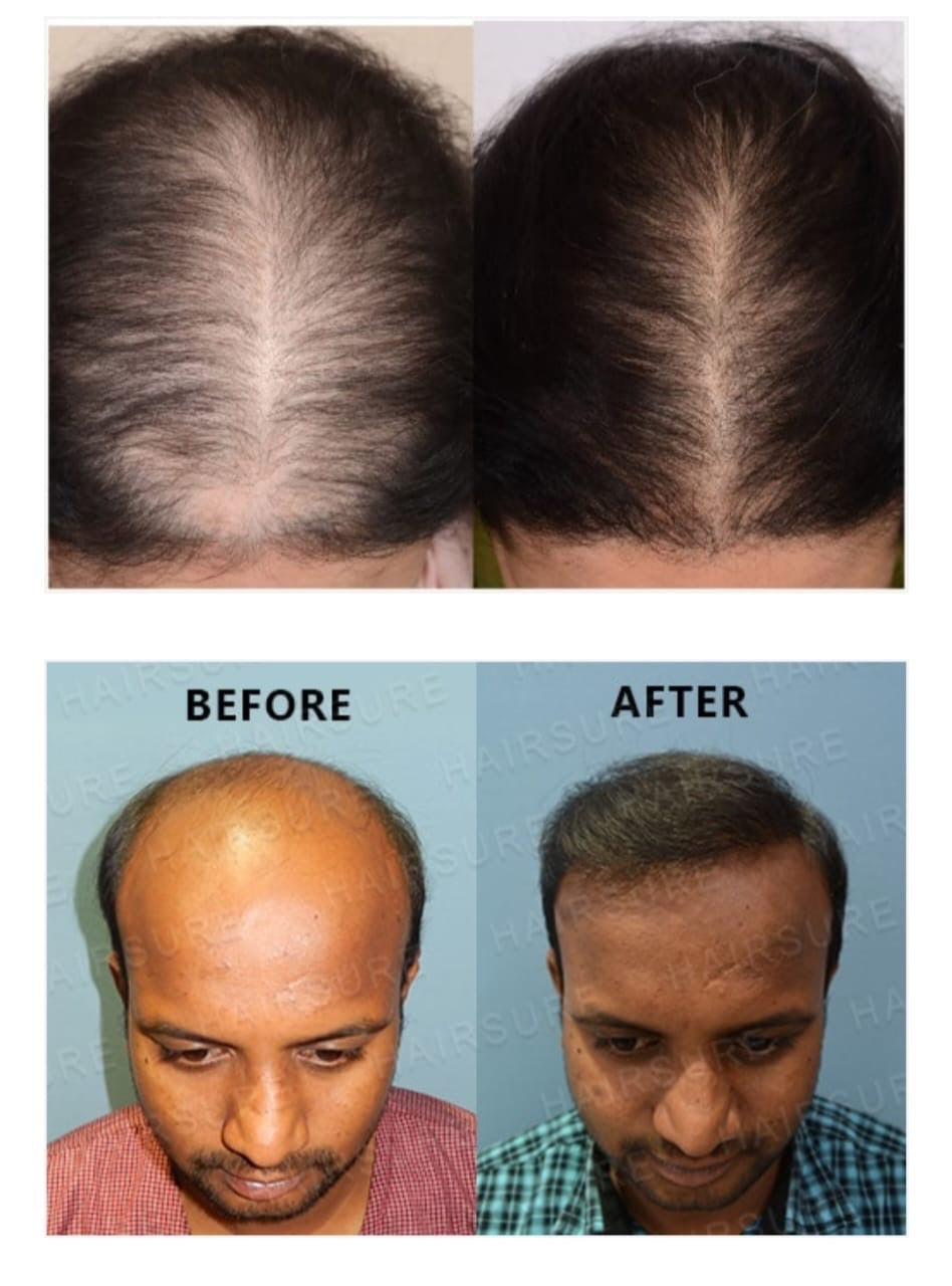 Adivasi hair oil